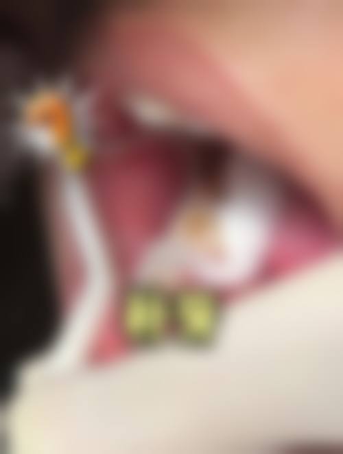 湖南长沙向日葵口腔真实实例