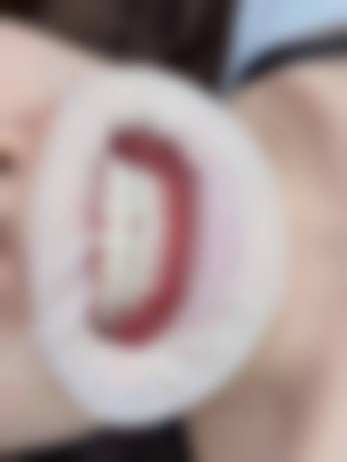 广州积美整形医院口腔科擅长项目