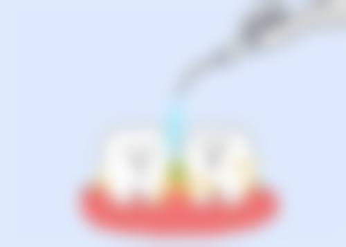 应急管理部应急总医院口腔科预约挂号方式