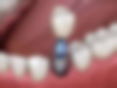 应急管理部应急总医院口腔科电话号码