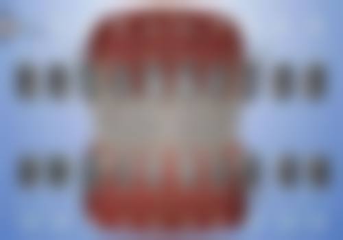 于文亮牙齿矫正与美学设计优势