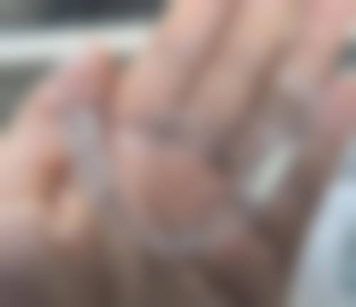特色项目详解:广东中山杨新口腔诊所在种植与正畸领域的出色表现