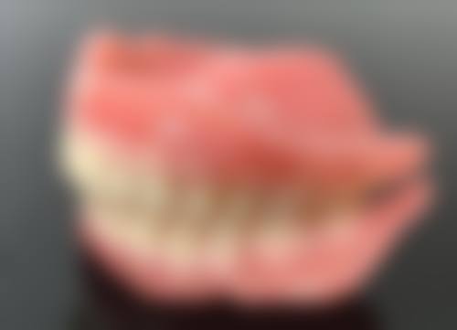 根管治疗完多久不疼？通常3-7天缓解，若长期剧痛或遇冷热刺激痛，警惕失败！
