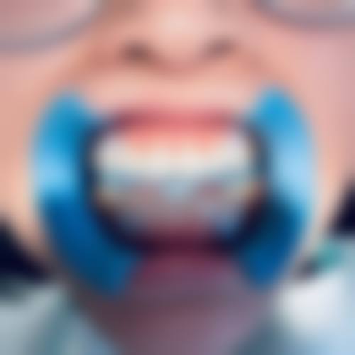 斯诺口腔门诊部价格透明与优惠活动