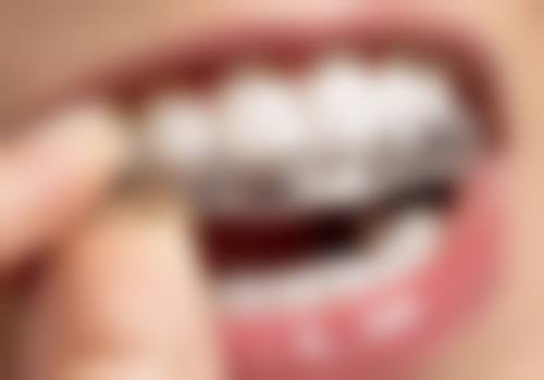 深圳七里香榭美哈口腔诊所的特色项目与服务流程详解