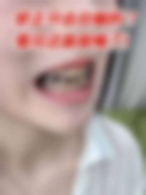 益阳高新博悦口腔诊所核心项目深度解析:种植、正畸与美学修复