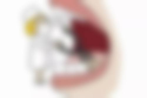 20岁种牙能行吗?早做优势多,稳固耐用更自信