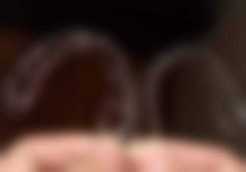 江西赣州于都大卫口腔特色项目:种植牙与牙齿矫正的深度解读
