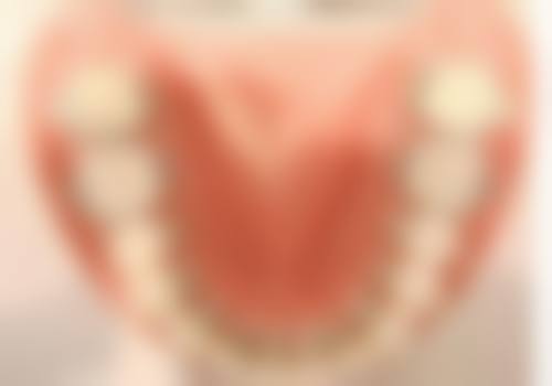 朱禹东患者真实口碑与常见问题解答
